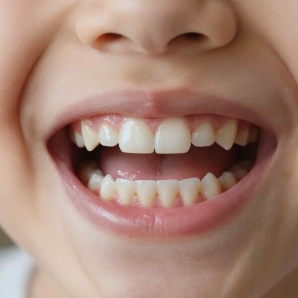 Ile jest zębów mlecznych