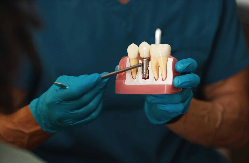 Implant zębowy krok po kroku – co dzieje się od konsultacji do odbudowy zęba?